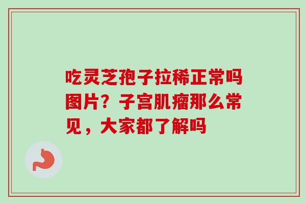 吃灵芝孢子拉稀正常吗图片？子宫肌瘤那么常见，大家都了解吗