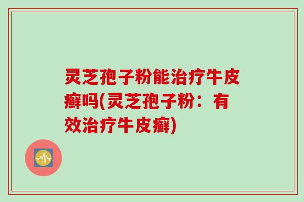 灵芝孢子粉能牛皮癣吗(灵芝孢子粉:有效牛皮癣) 灵芝孢子粉能牛皮癣吗(灵芝孢子粉:有效牛皮癣)