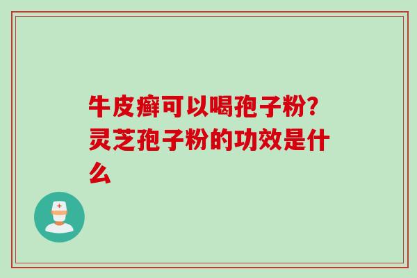 牛皮癣可以喝孢子粉?灵芝孢子粉的功效是什么 牛皮癣可以喝孢子粉?灵芝孢子粉的功效是什么